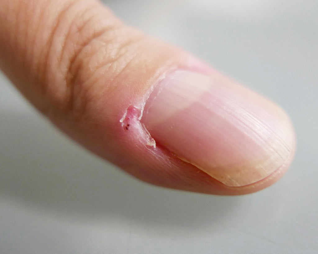 Are Cuticles Your Biggest Problem?